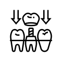 Crowns-and-Bridges.png