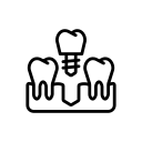 Dental-Implants-4-1.png