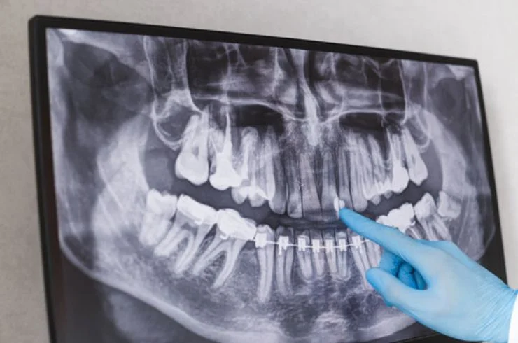 Dental X-rays-9