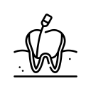 root-canal-4.png